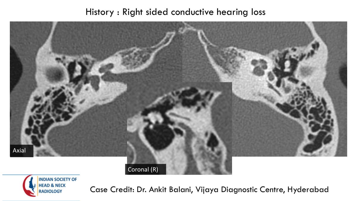 Case 81 — slide 1 of 2
