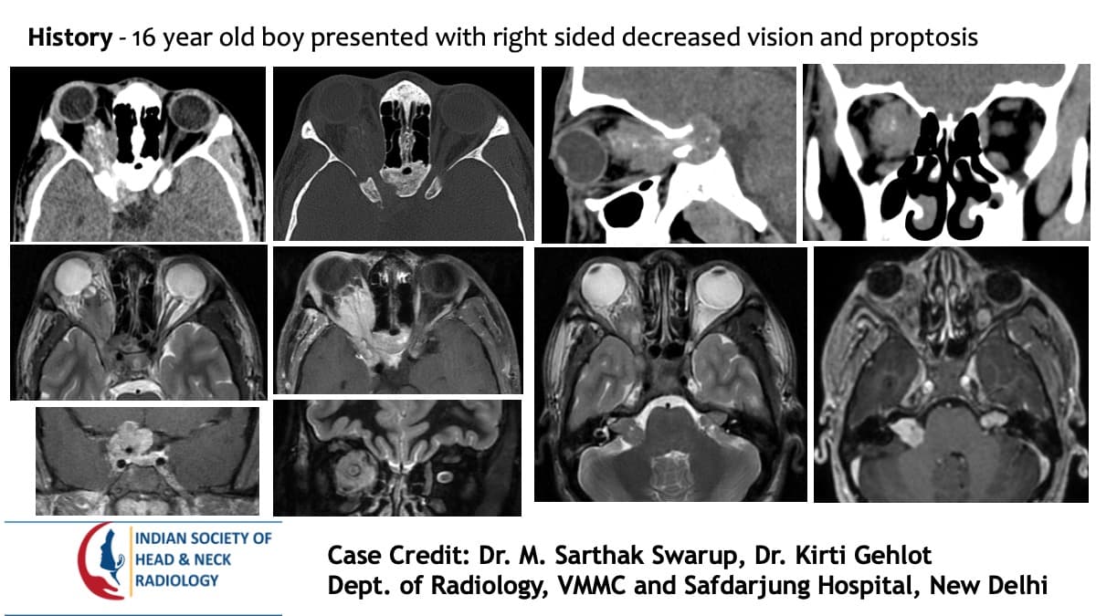 Case 86 — slide 1 of 3