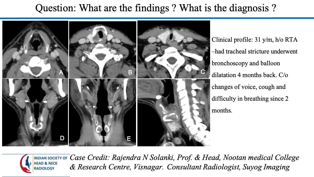 Case 88 — slide 1 of 4