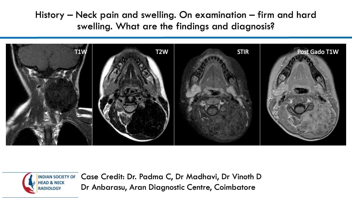 Case 84 — slide 1 of 3