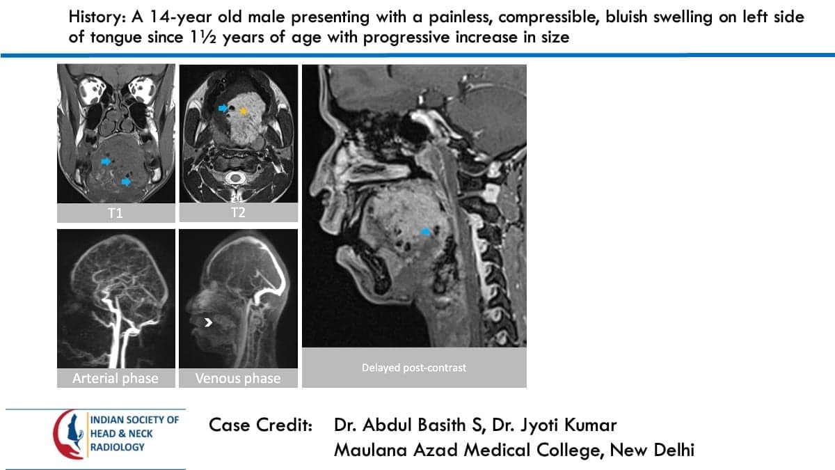 Case 85 — slide 1 of 3