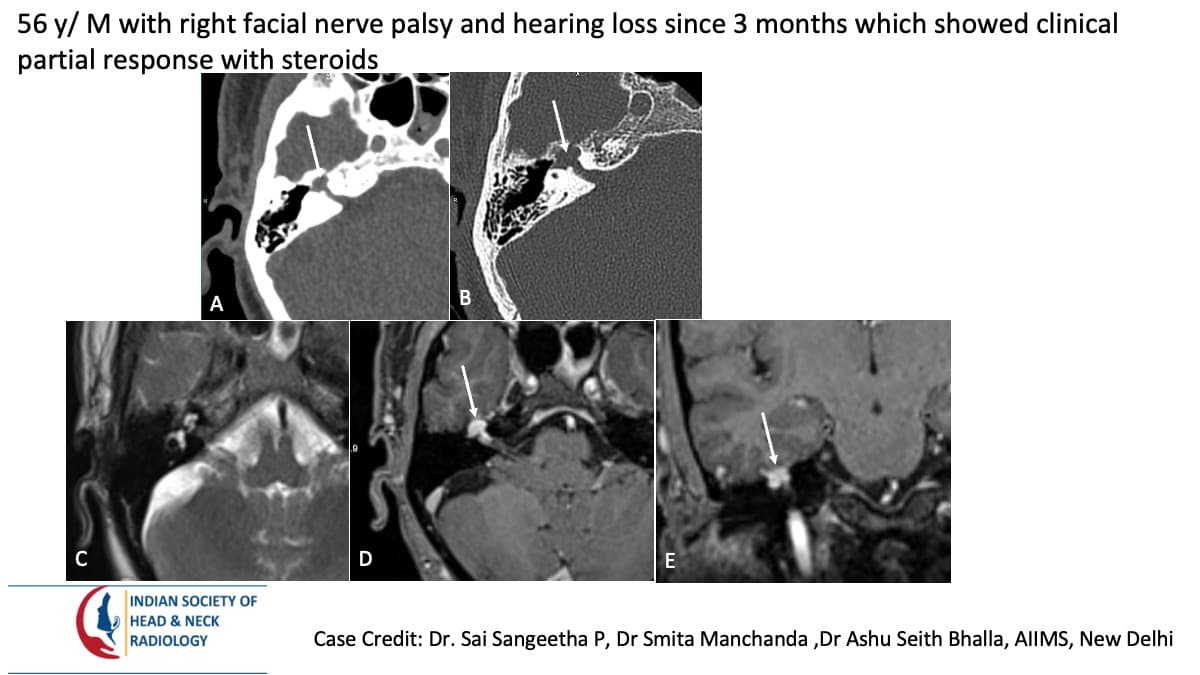 Case 82 — slide 1 of 3