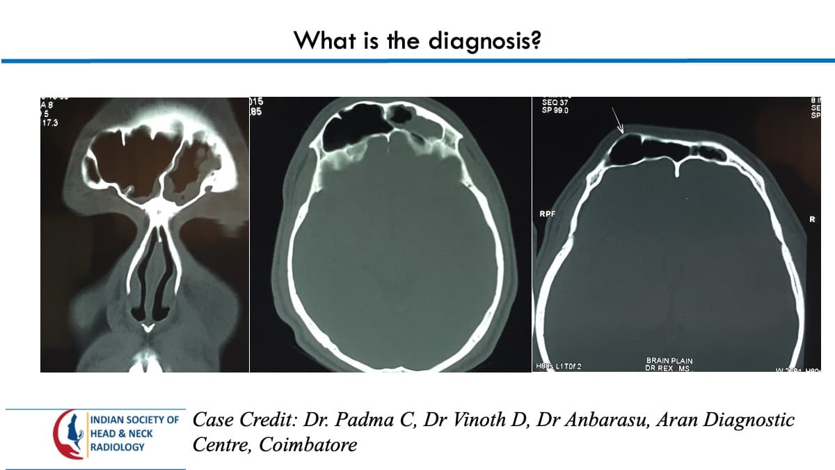 Case 90 — slide 1 of 2