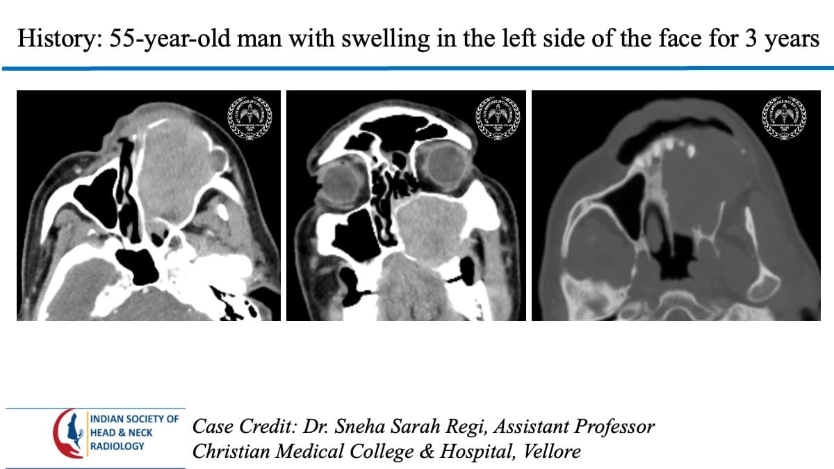 Case 91 — slide 1 of 3