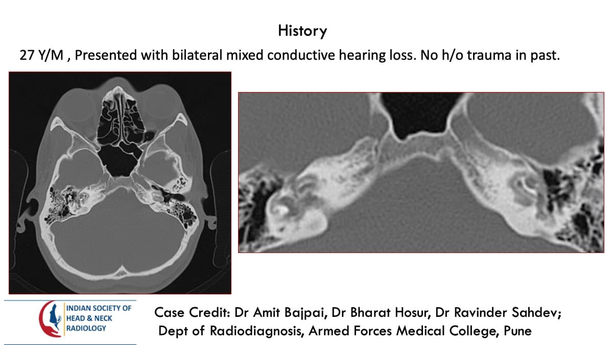 Case 92 — slide 1 of 3