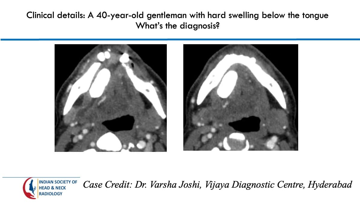 Case 94 — slide 1 of 4