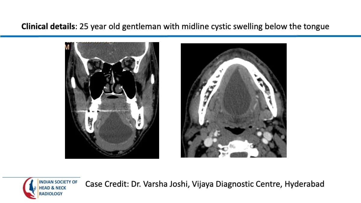 Case 95 — slide 1 of 3