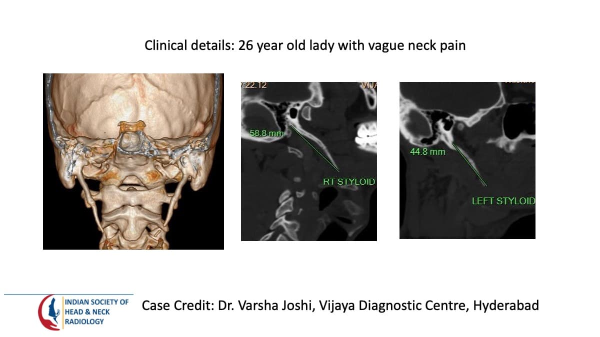 Case 101 — slide 1 of 3