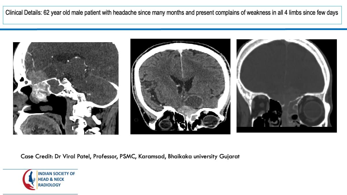Case 102 — slide 1 of 4