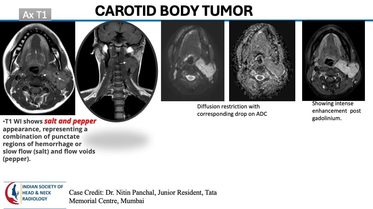 Case 104 thumbnail 3