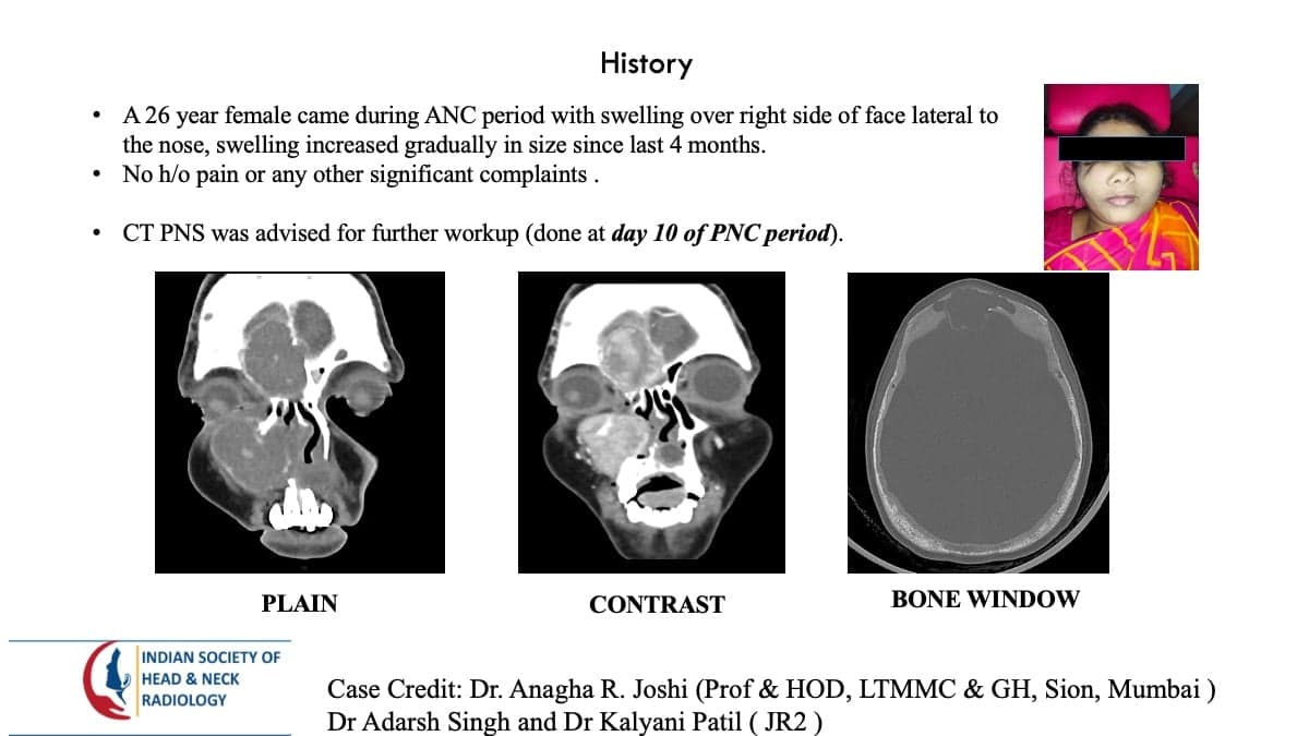 Case 105 — slide 1 of 4