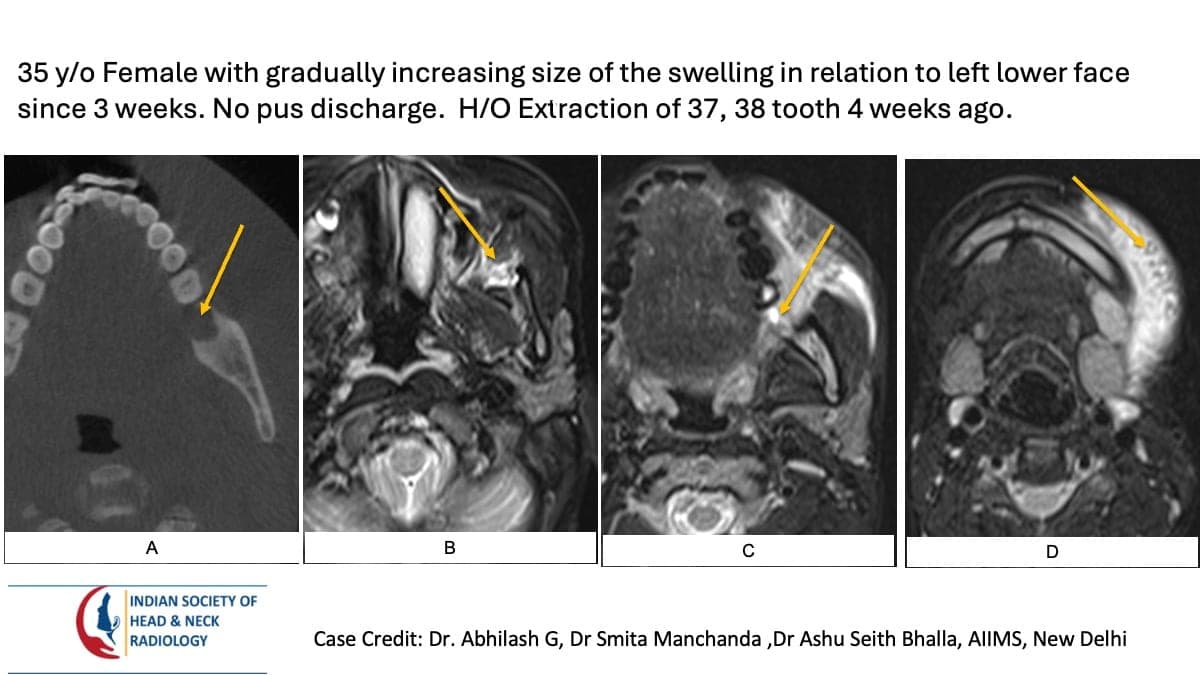 Case 106 — slide 1 of 3