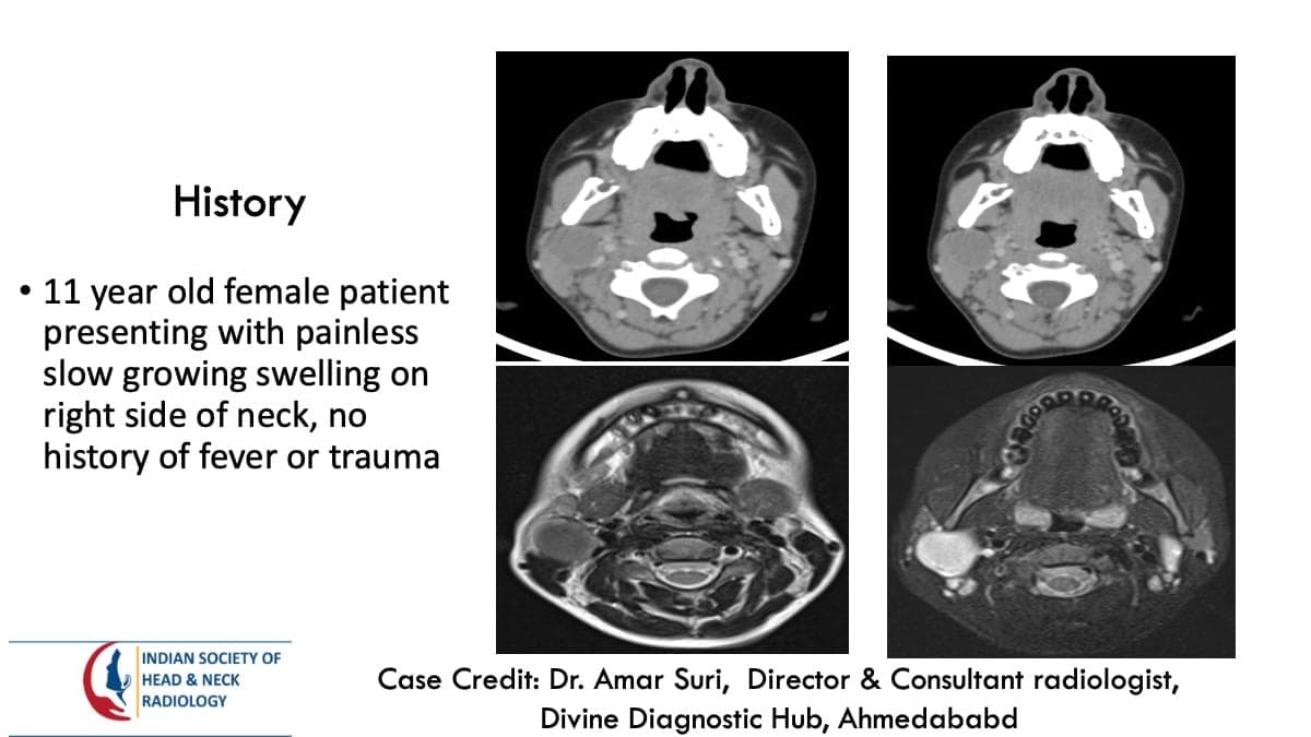 Case 107 — slide 1 of 4
