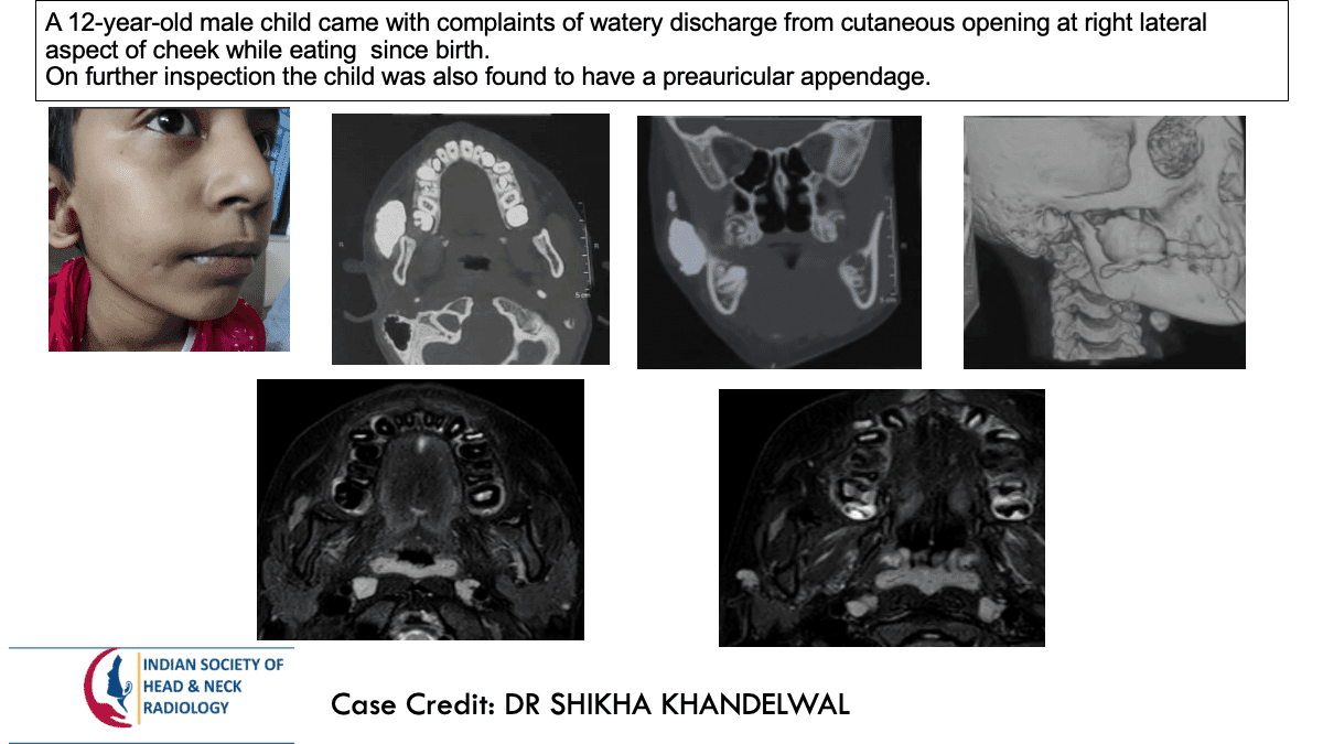 Case 110 — slide 1 of 2