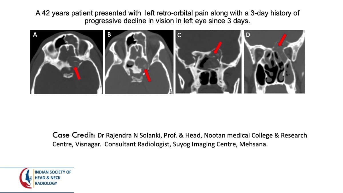 Case 111 — slide 1 of 6