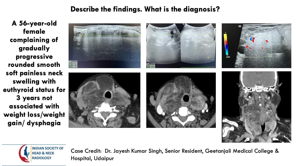 Case 112 — slide 1 of 7