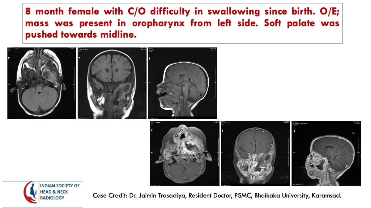 Case 113 — slide 1 of 4