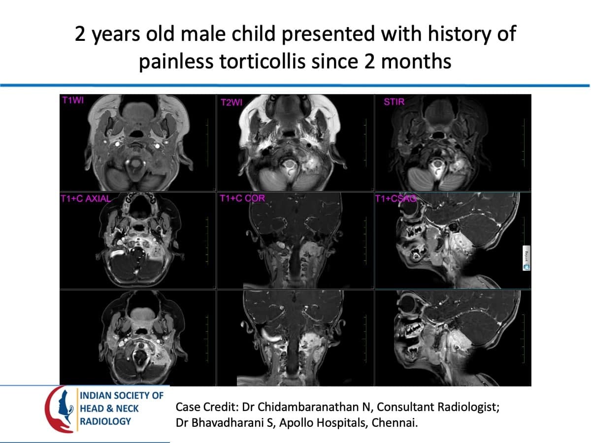 Case 114 — slide 1 of 5