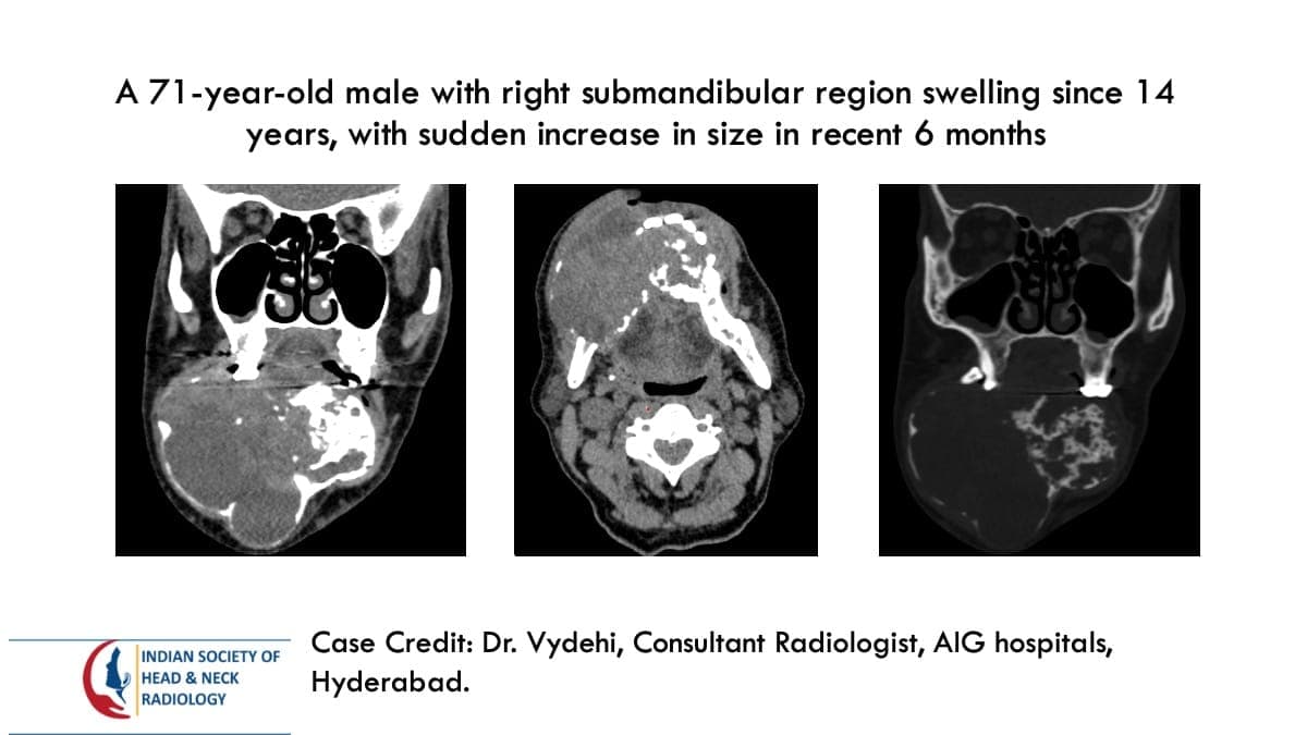 Case 115 — slide 1 of 3