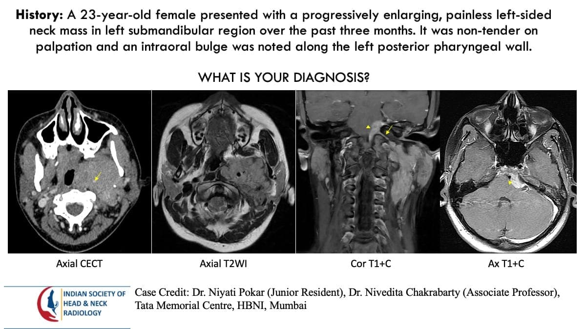 Case 116 — slide 1 of 4