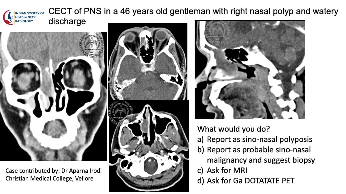 Case 117 — slide 1 of 4