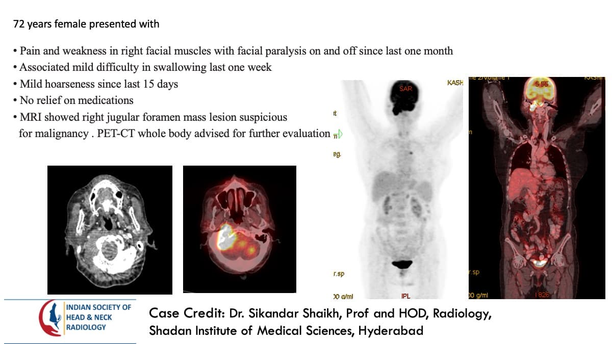 Case 118 — slide 1 of 3