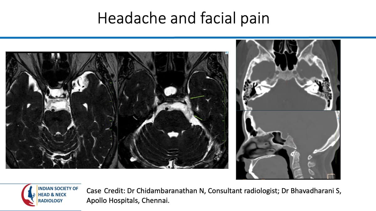 Case 121 — slide 1 of 5