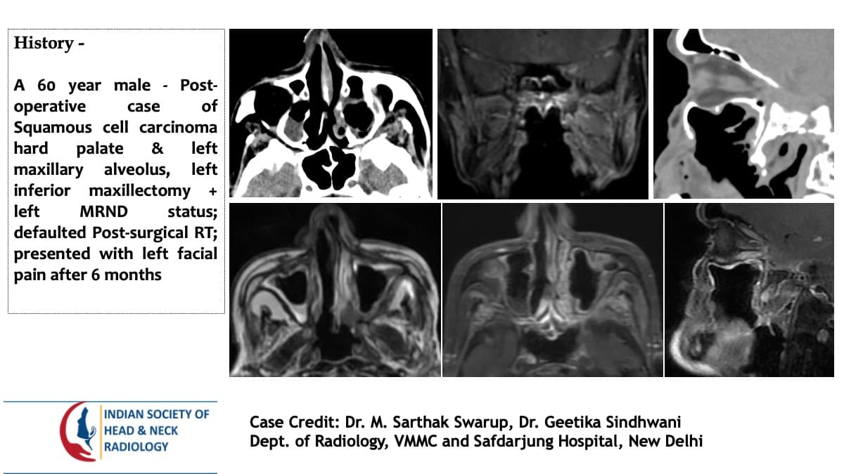 Case 122 — slide 1 of 4