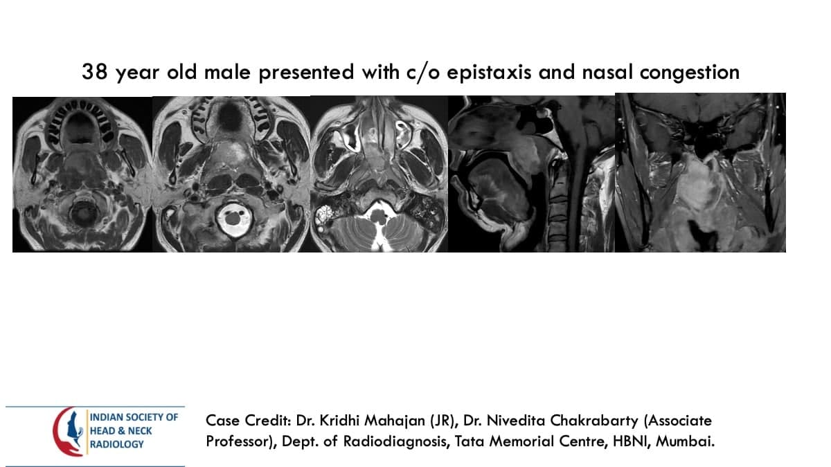 Case 125 — slide 1 of 3