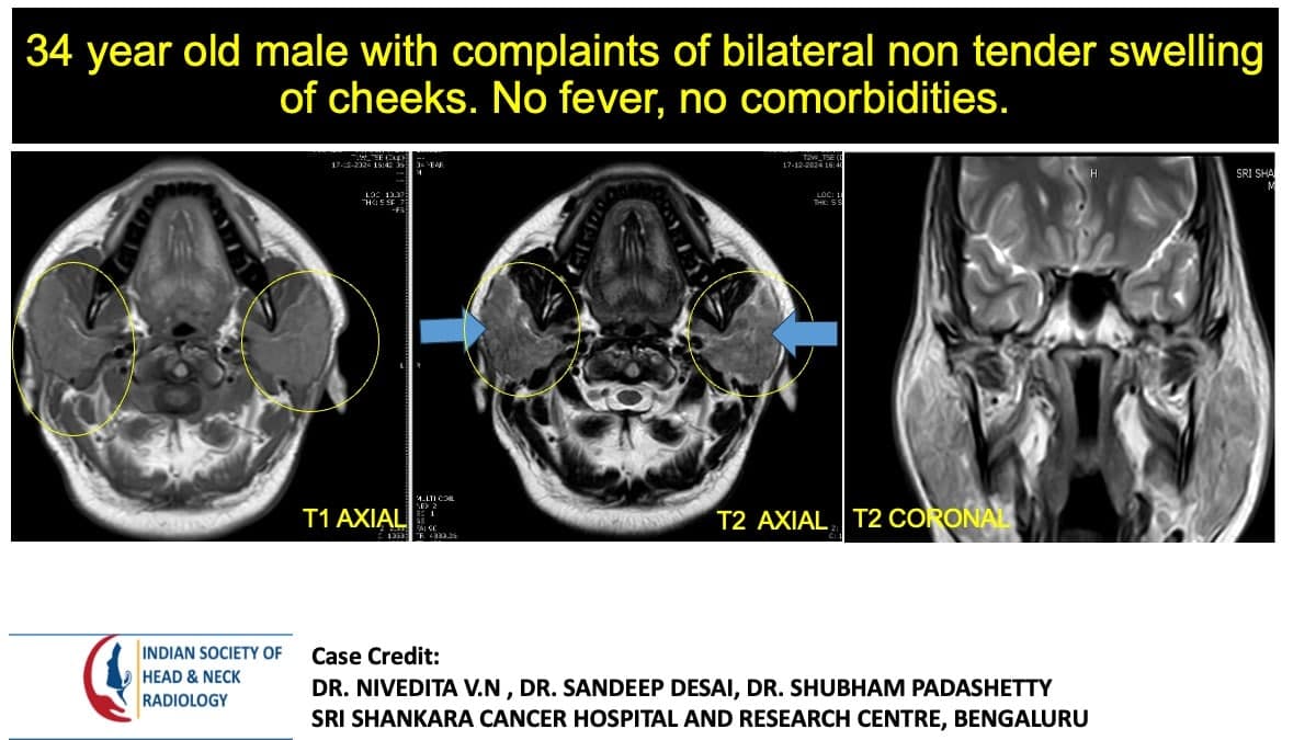 Case 126 — slide 1 of 6