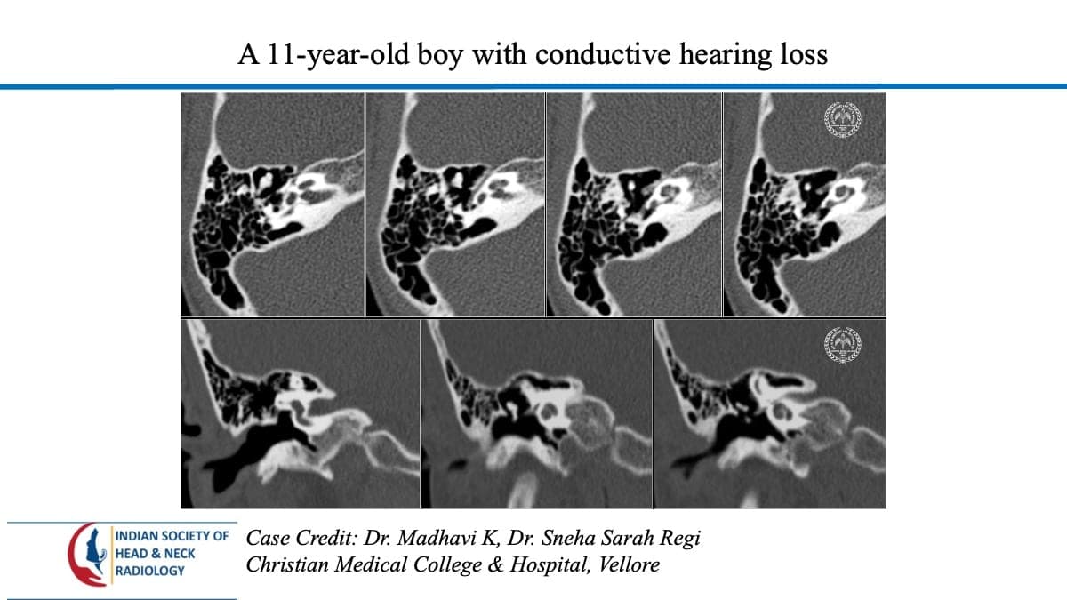 Case 128 — slide 1 of 4