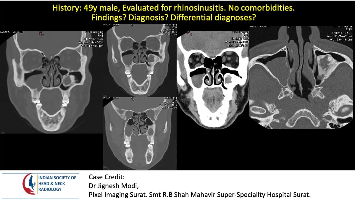 Case 130 — slide 1 of 4