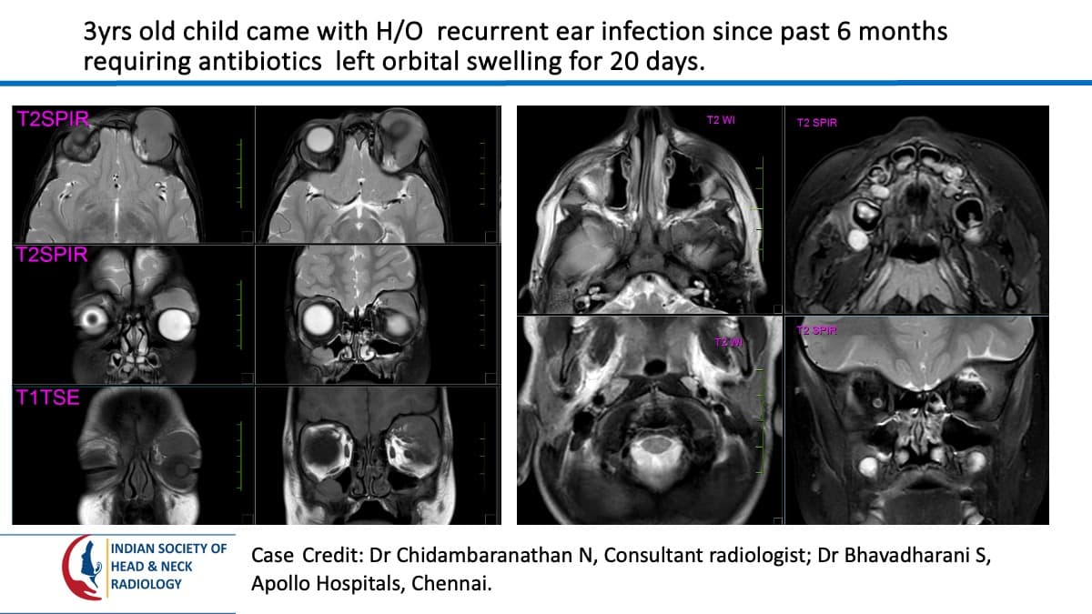 Case 131 — slide 1 of 5