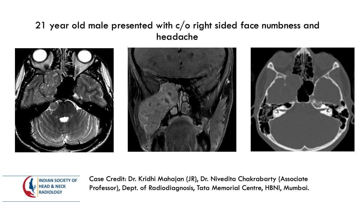 Case 132 — slide 1 of 2