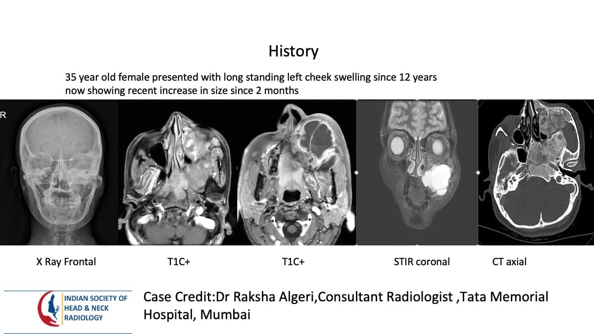 Case 137 — slide 1 of 3
