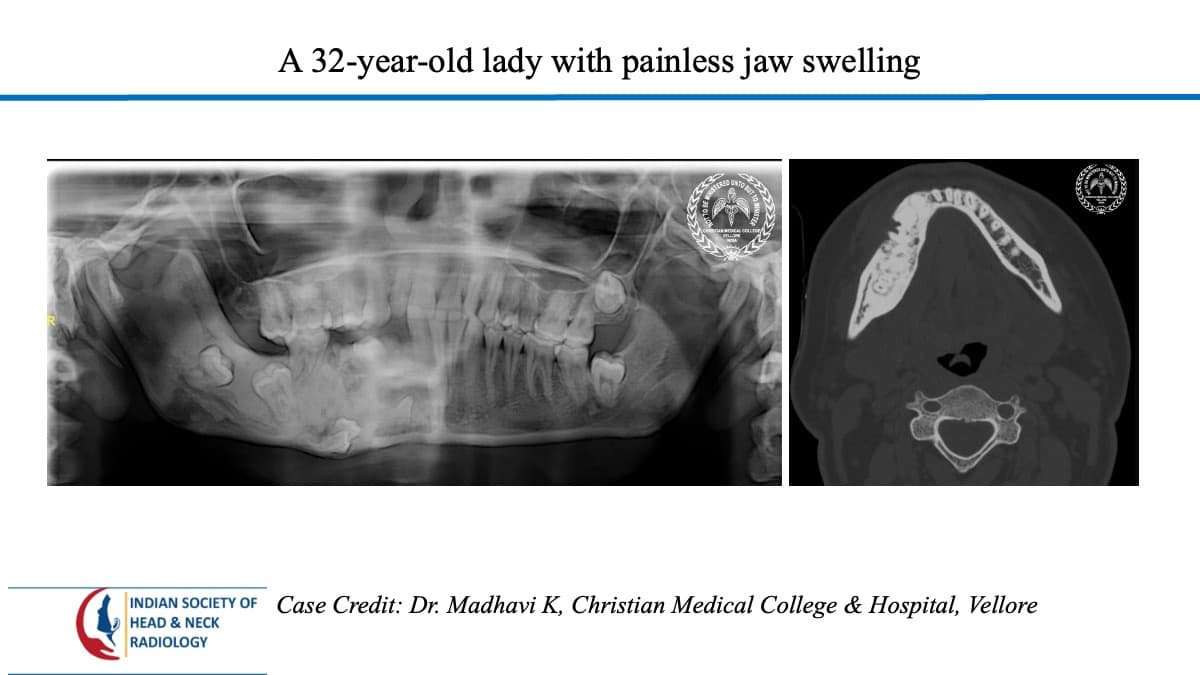 Case 140 — slide 1 of 3