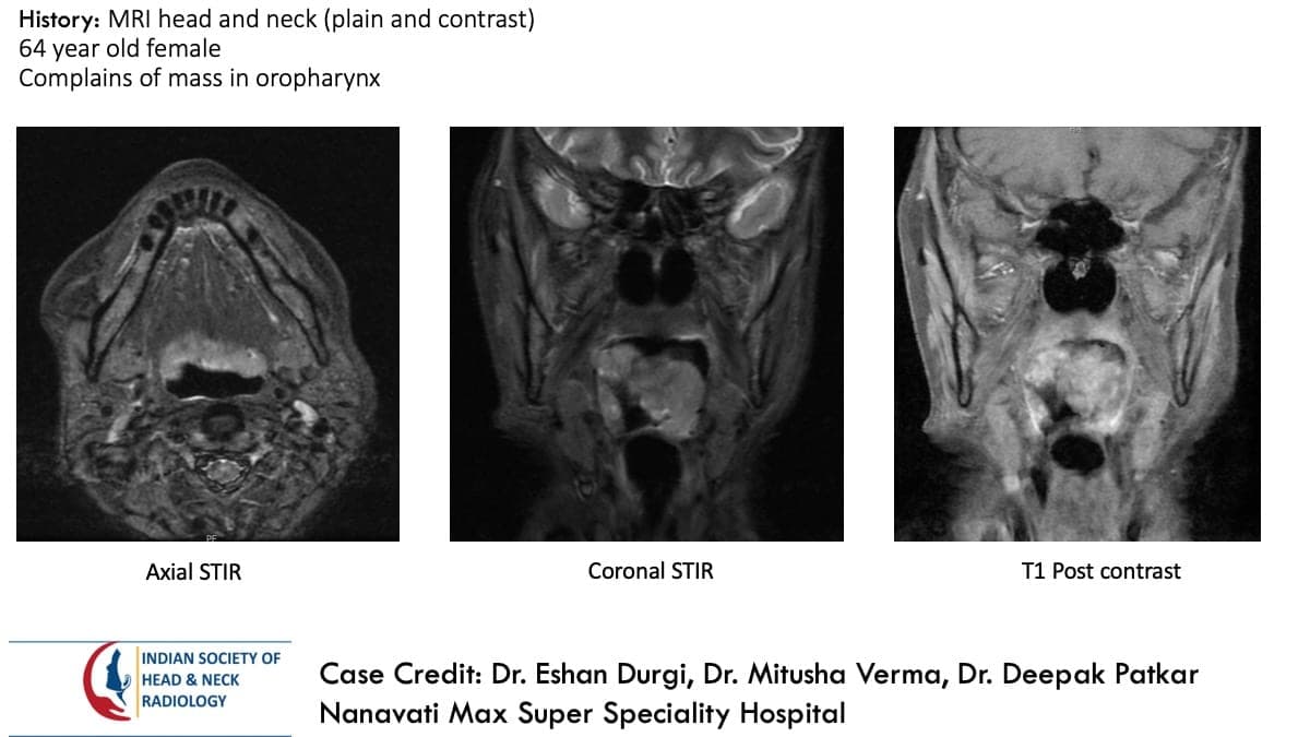 Case 142 — slide 1 of 3