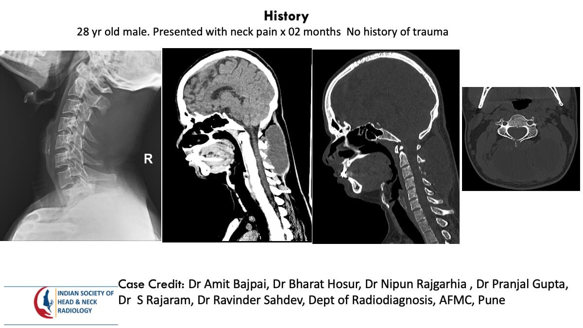 Case 144 — slide 1 of 8