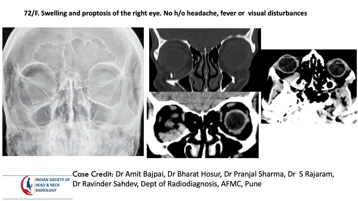 Case 145 — slide 1 of 6