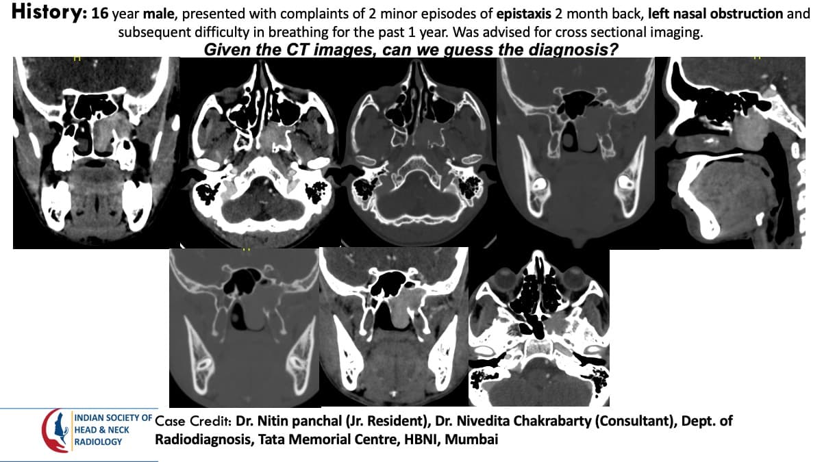 Case 146 — slide 1 of 4