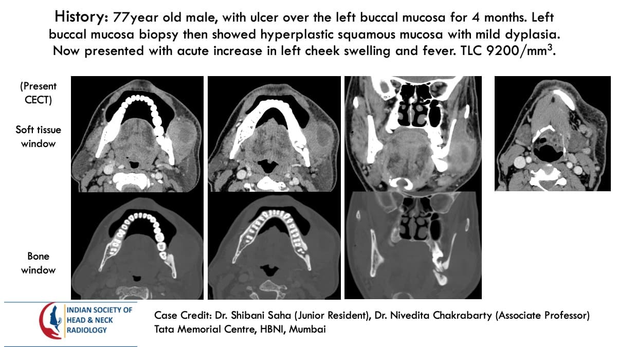 Case 150 — slide 1 of 4
