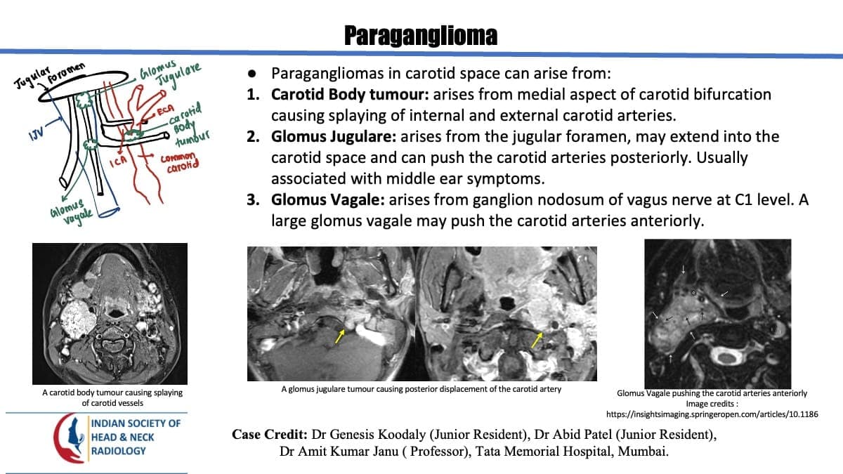 Case 155 thumbnail 5