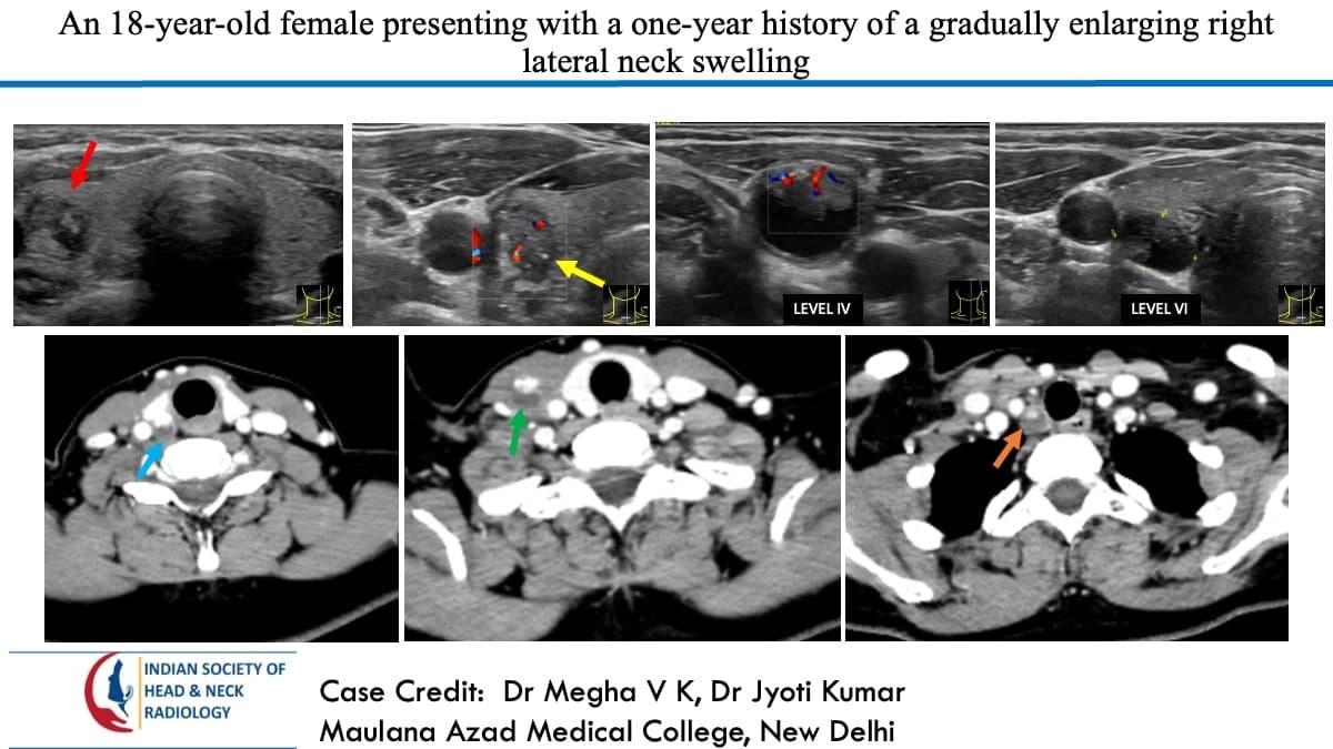 Case 157 — slide 1 of 3