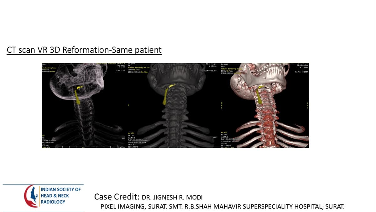 Case 164 thumbnail 3