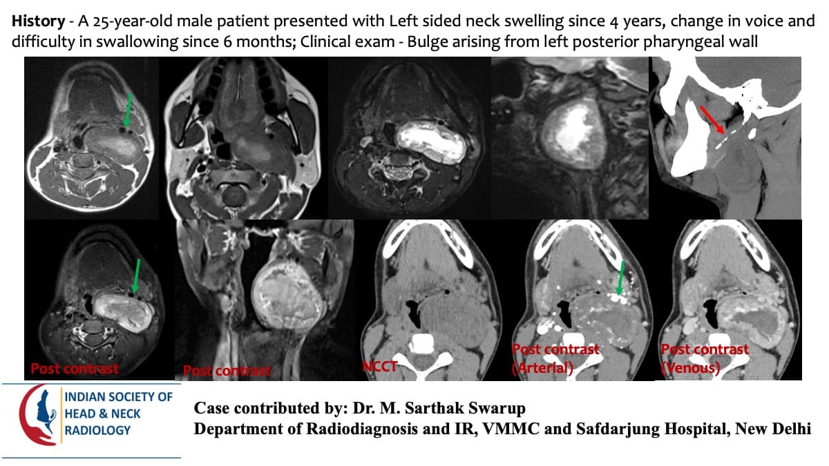 Case 166 — slide 1 of 3