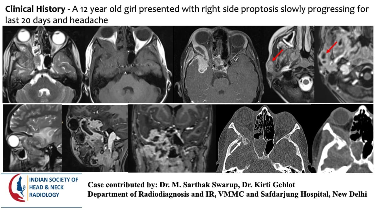 Case 170 — slide 1 of 3