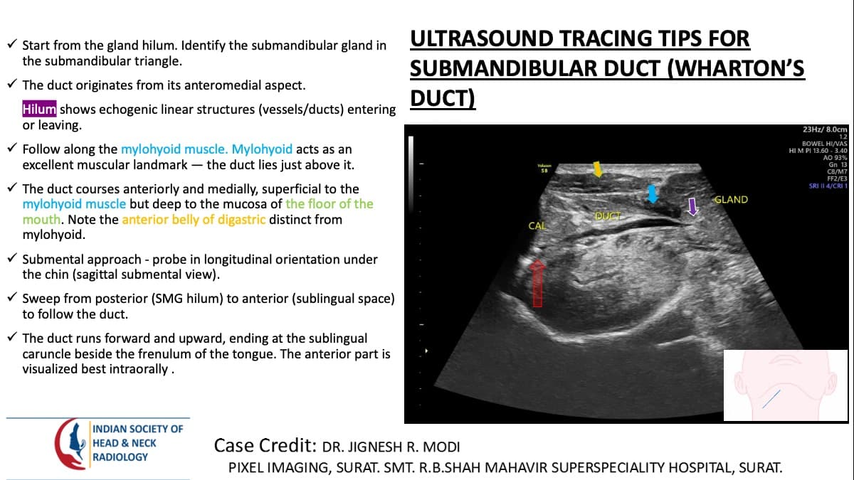Case 172 thumbnail 3