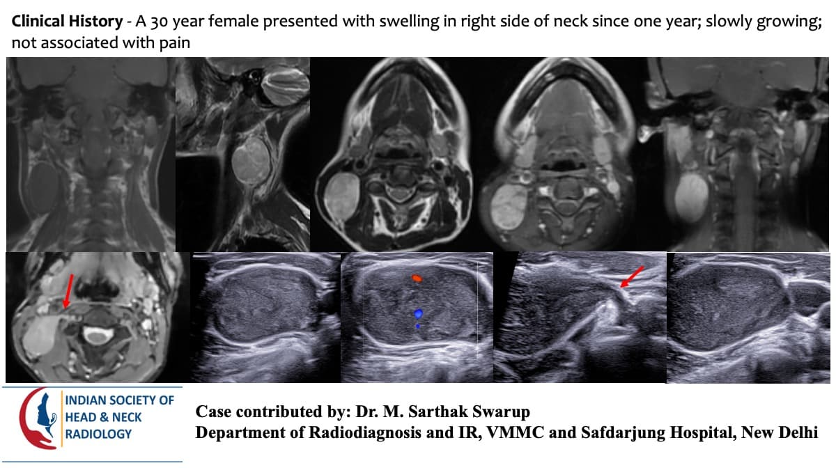 Case 174 — slide 1 of 3