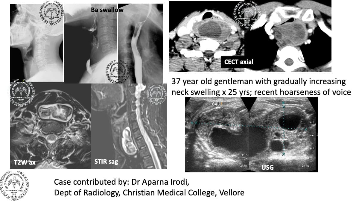 Case 182 — slide 1 of 4