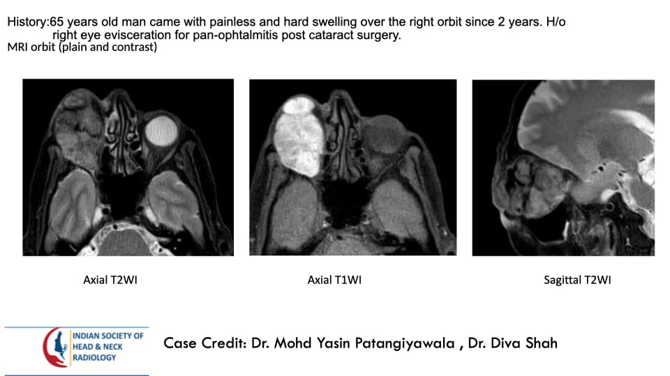 Case 192 — slide 1 of 5